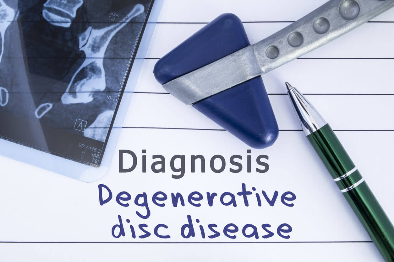 What Is Degenerative Disc Disease? - Orthopedic & Sports Medicine